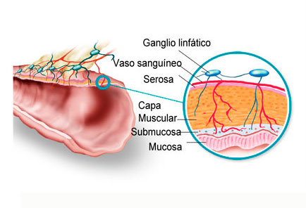 relaci&oacute;n del colon y el sistema linfático